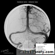 vascular neurosurgery