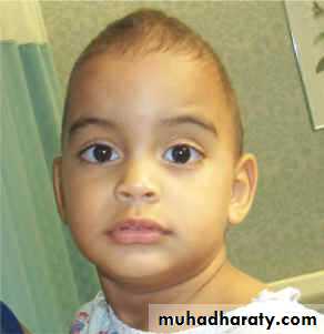 Developmental Abnormalities of the Nervous System