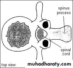 Developmental Abnormalities of the Nervous System