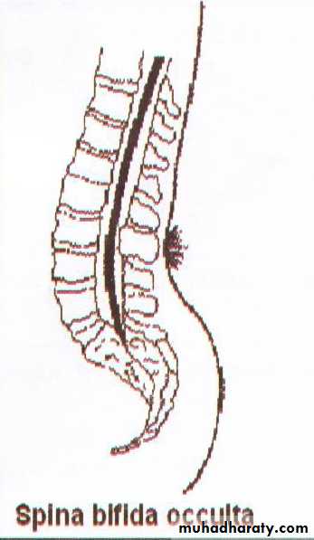 Developmental Abnormalities of the Nervous System