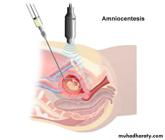 Developmental Abnormalities of the Nervous System