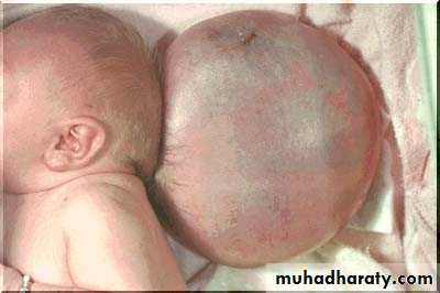 Developmental Abnormalities of the Nervous System