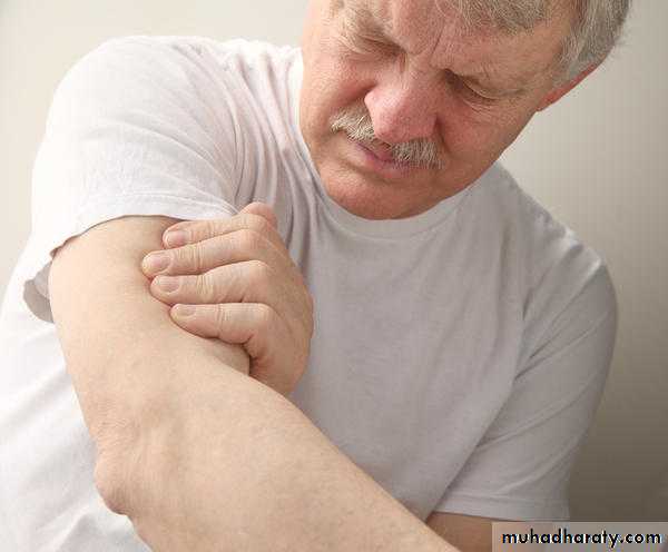 frcature spine and peripheral nerve