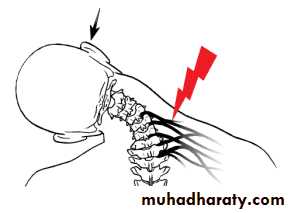 frcature spine and peripheral nerve