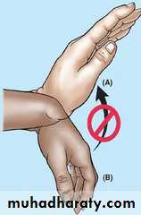 frcature spine and peripheral nerve