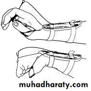 frcature spine and peripheral nerve