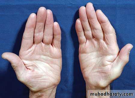 frcature spine and peripheral nerve