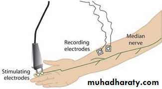 frcature spine and peripheral nerve