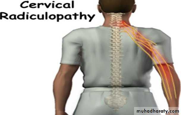 frcature spine and peripheral nerve