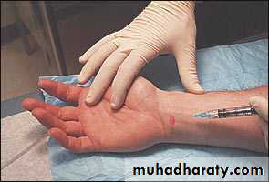 frcature spine and peripheral nerve
