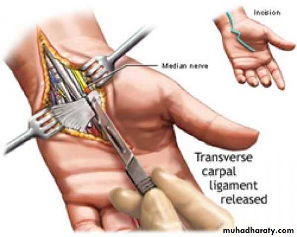 frcature spine and peripheral nerve