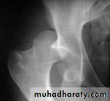 frcature spine and peripheral nerve