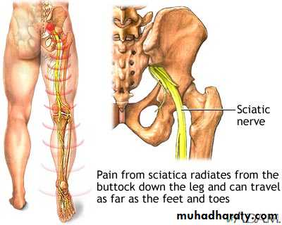 frcature spine and peripheral nerve