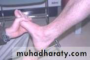 frcature spine and peripheral nerve