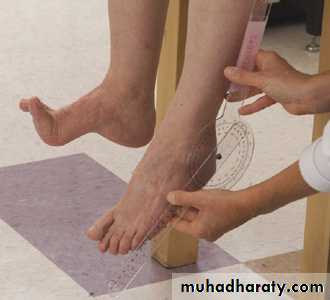 frcature spine and peripheral nerve