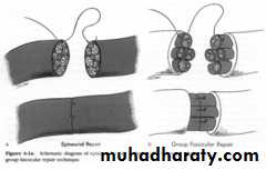 frcature spine and peripheral nerve
