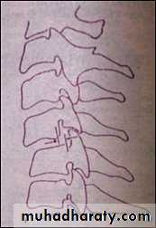 frcature spine and peripheral nerve