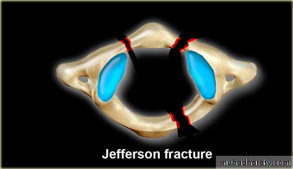 frcature spine and peripheral nerve