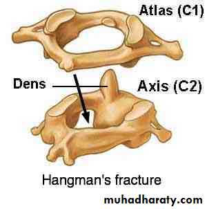 frcature spine and peripheral nerve
