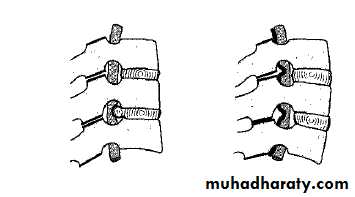 frcature spine and peripheral nerve