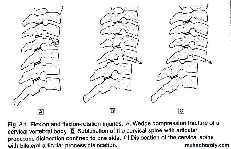 frcature spine and peripheral nerve