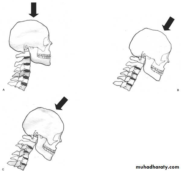 frcature spine and peripheral nerve