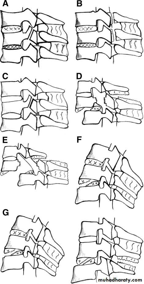 frcature spine and peripheral nerve