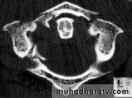frcature spine and peripheral nerve