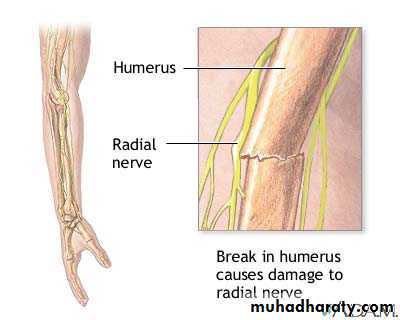 frcature spine and peripheral nerve