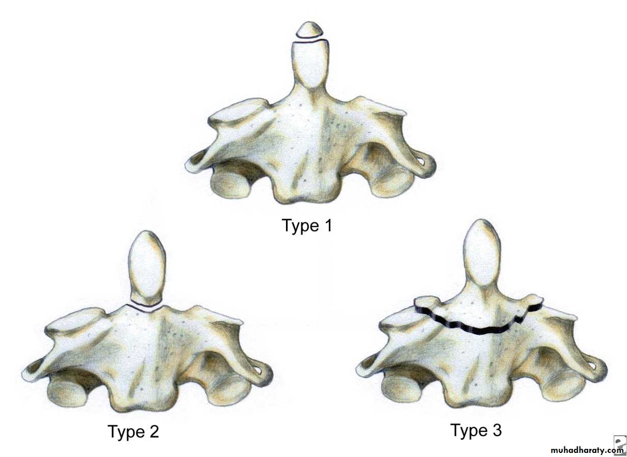 frcature spine and peripheral nerve