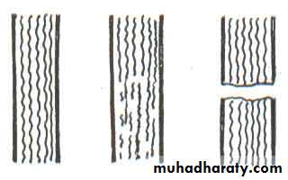 frcature spine and peripheral nerve