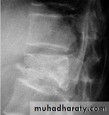 frcature spine and peripheral nerve