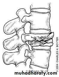 frcature spine and peripheral nerve