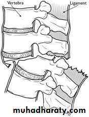frcature spine and peripheral nerve