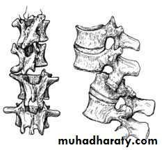frcature spine and peripheral nerve