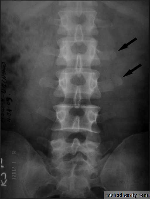 frcature spine and peripheral nerve