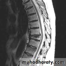 frcature spine and peripheral nerve