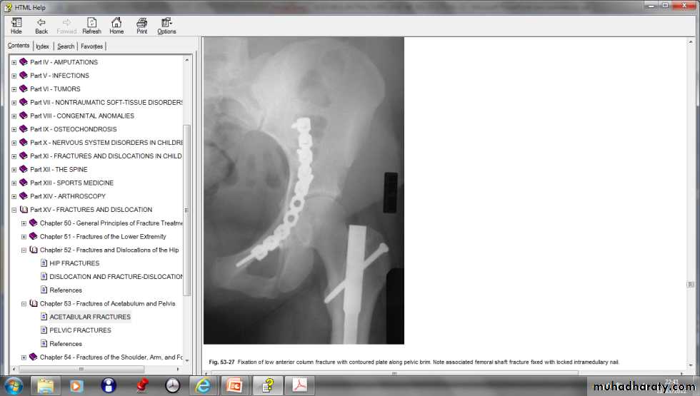 pelvic_fracture