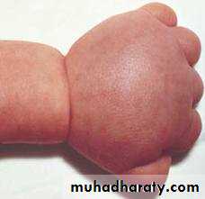 GENETICS4