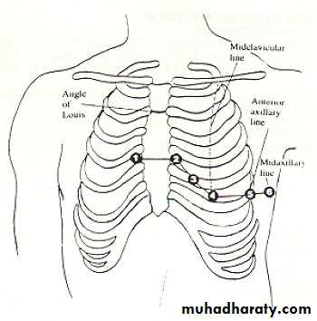 2 THE 12 LEADS STNDARD ECG