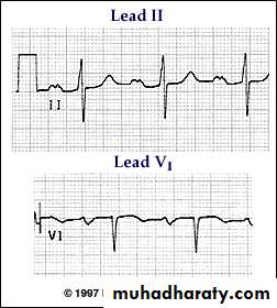 2 THE 12 LEADS STNDARD ECG