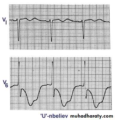 2 THE 12 LEADS STNDARD ECG