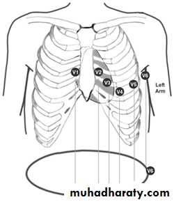 2 THE 12 LEADS STNDARD ECG