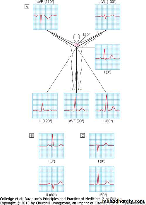 2 THE 12 LEADS STNDARD ECG