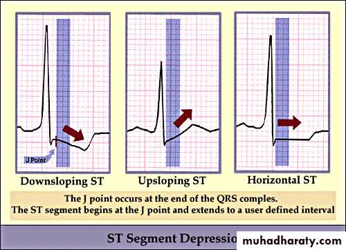 2 THE 12 LEADS STNDARD ECG