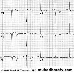 2 THE 12 LEADS STNDARD ECG