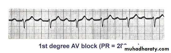 2 THE 12 LEADS STNDARD ECG