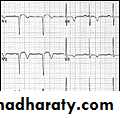 2 THE 12 LEADS STNDARD ECG