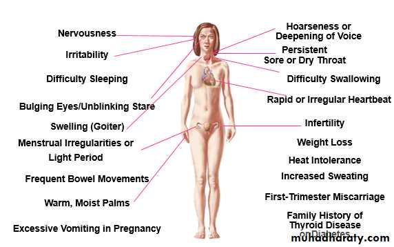 Hyperthyroidism
