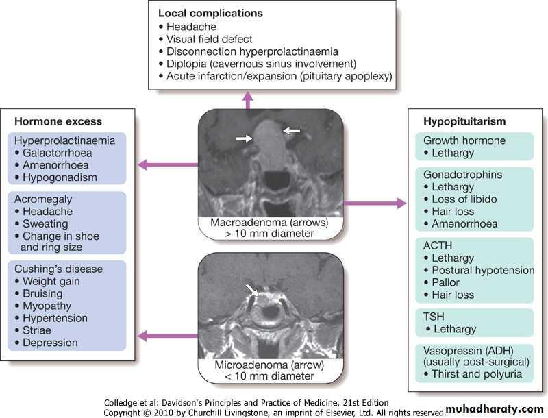 pituitary